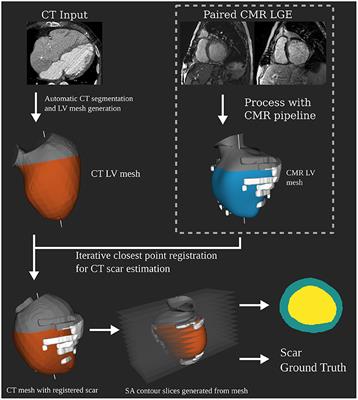 Automated Left Ventricle Ischemic Scar Detection in CT Using Deep Neural Networks